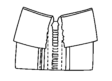 Figure 20. Finishing neckline facings over zippers